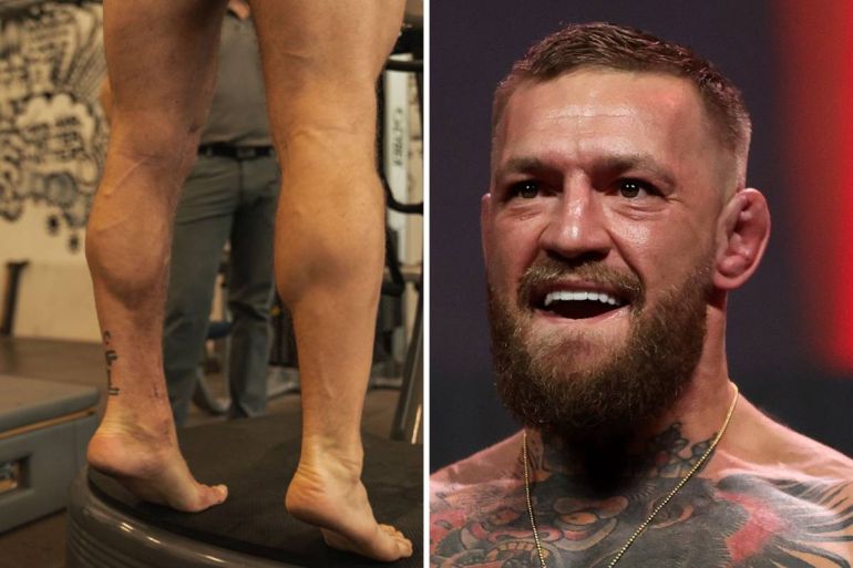 Conor McGregor Provides Update On Recovery From Leg Break